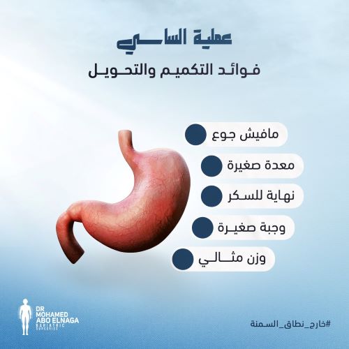 تجربتي مع عملية الساسي
